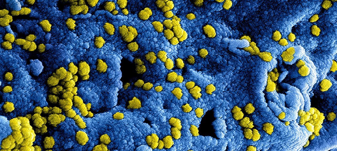 Imagen digital del coronavirus MERS.