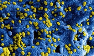 The MERS coronavirus, digitally imaged.