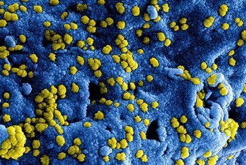 Цифровое изображение коронавируса Ближневосточного респираторного синдрома (БВРС-КоВ)