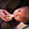 تقدم اليونيسف في الصومال خدمات التدخل الغذائي للأطفال الذين يعانون من سوء التغذية.