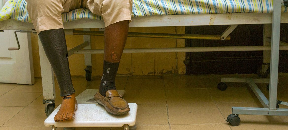 Un hombre de 54 años con diabetes tipo 2 en Nigeria con el pie derecho amputado