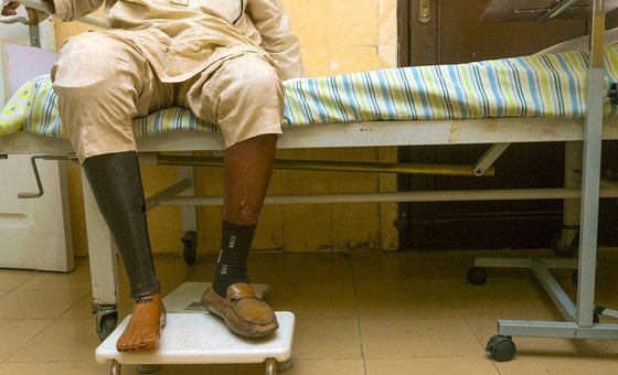 Paciente da Nigéria teve seu pé amputada devido a complicações causadas por diabetes