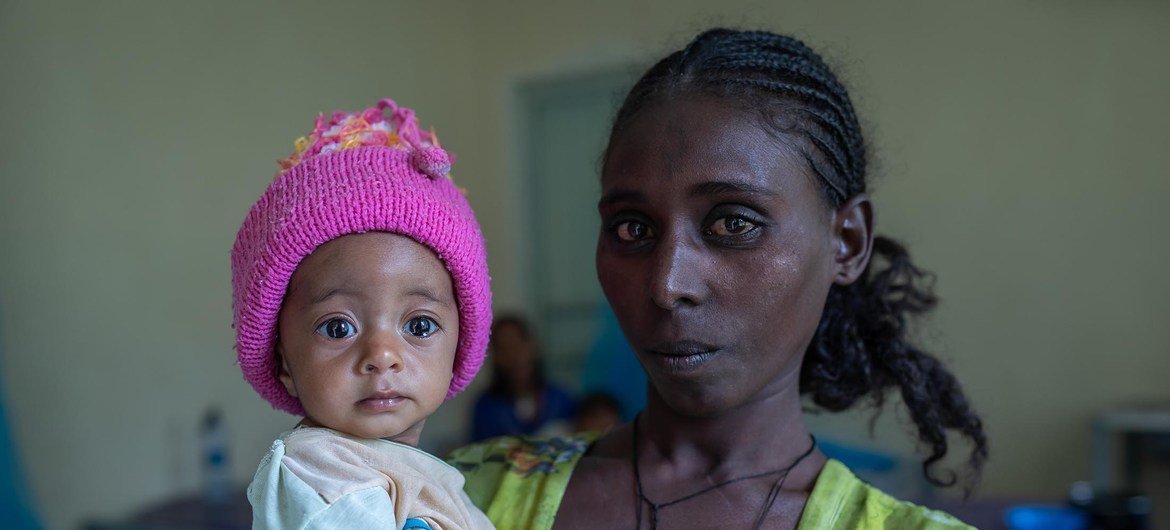 इथियोपिया के टीगरे क्षेत्र में, एक 27 वर्षीय महिला अपनी 6 महीने की बेटी के साथ एक स्वास्थ्य केन्द्र पर. ये बच्ची कुपोषण से पीड़ित है.