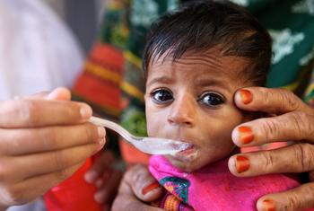 Un niño de cuatro meses comiendo en un hospital de la provincia de Punjab (Pakistán).