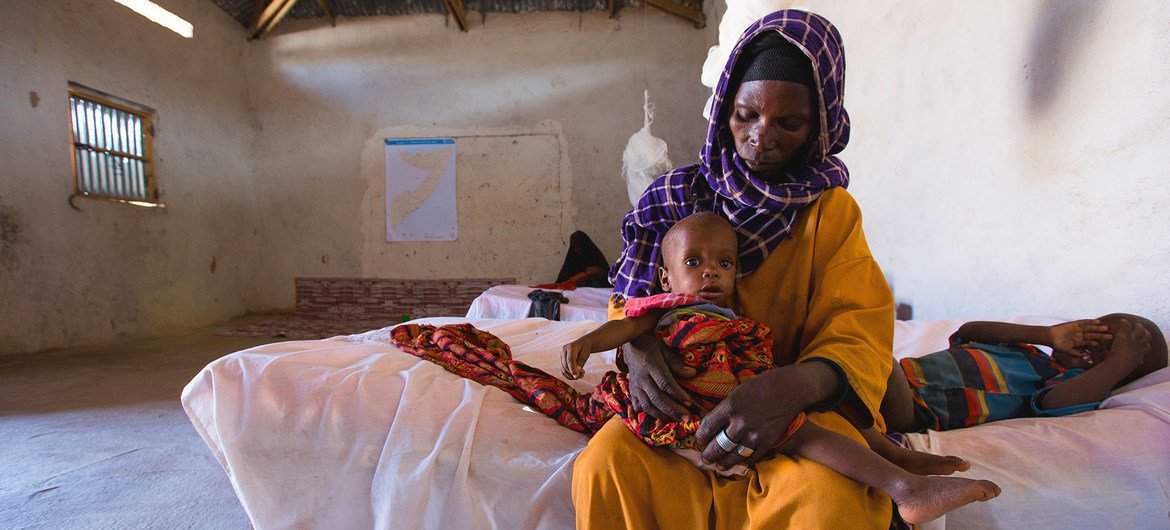 Enfermaria de hospital para crianças com desnutrição aguda grave na Somália