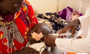 Un enfant âgé de six mois au Soudan du Sud reçoit du lait à travers un tube.