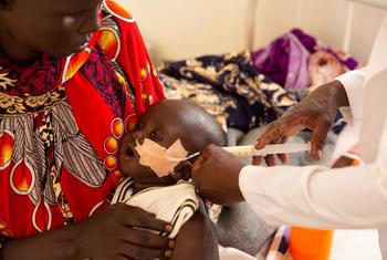 طفل يبلغ من العمر ستة أشهر يعاني من سوء التغذية في جنوب السودان يتلقى الحليب من خلال أنبوب التغذية.