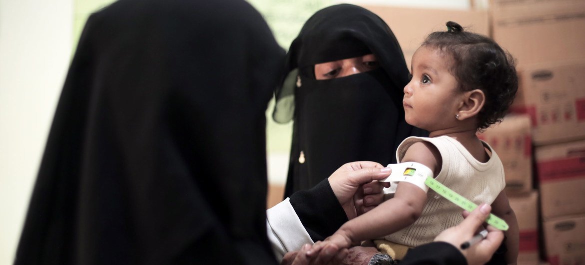 طفلة تبلغ تسعة أشهر من العمر تعاني من سوء التغذية يتم فحصها من قبل طاقم طبي في أحد المراكز الصحية في صنعاء.