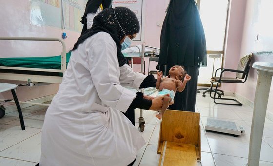 Двухмесячный ребенок, страдает от тяжелого недоедания, его взвешивает медсестра в больнице города Адена, Йемен