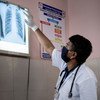 A doctor in Gujarat, India, checks a patient’s chest x-ray for signs of tuberculosis or other lung infections.