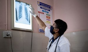 Um médico em Gujarat, Índia, verifica a radiografia de tórax de um paciente em busca de sinais de tuberculose ou outras infecções pulmonares