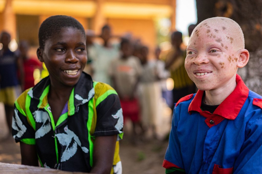 14岁的钦辛希是马拉维的一位白化病儿童。 
