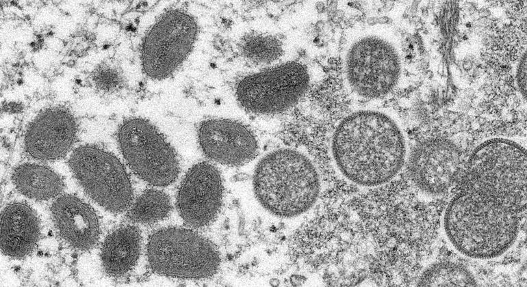 猴痘是一种罕见但危险的传染病，类似于现已根除的天花病毒。