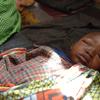 A five-year-old boy suffering from monkeypox rests in a health centre in a displaced camp in North Kivu, Democratic Republic of the Congo. (file)