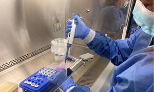 Profesionales de laboratorio de nueve países de las Américas y de México se capacitan en la detección de la viruela del mono con el respaldo del InDRE y de OPS.