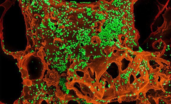 Middle East respiratory syndrome कोरोनावायरस से संक्रमित सैल. 