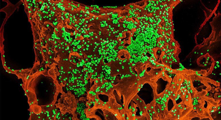 Célula infectada por el coronavirus MERS