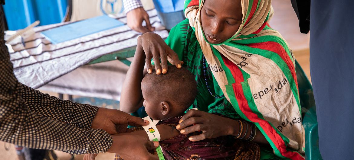 一名一岁女童在索马里多娄的一家由粮食署资助的诊所接受营养不良治疗。