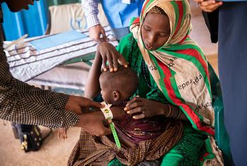 A one-year-old girl is treated for malnutrition at a WFP-funded clinic in Dolow in Somalia.
