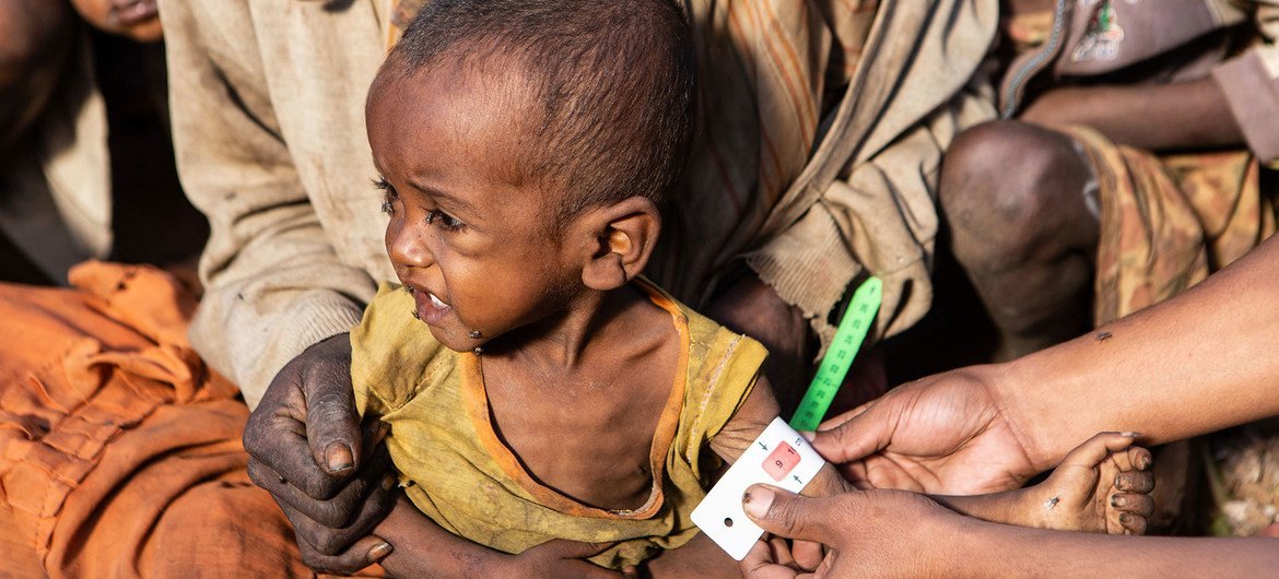 Crianças menores de cinco anos entre as mais afetadas pela desnutrição no Madagáscar. 