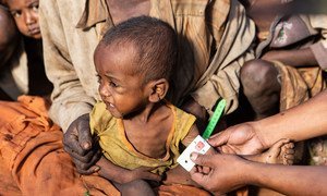 Les enfants de moins de cinq ans sont parmi les plus touchés par la malnutrition dans le sud de Madagascar.