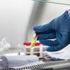 تم طرح الاختبارات السريعة لفيروس كورونا التاجي في أفريقيا.