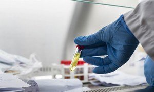 تم طرح الاختبارات السريعة لفيروس كورونا التاجي في أفريقيا.