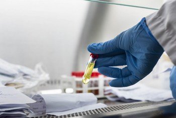 Des tests de diagnostic rapide à base d'antigènes approuvés par l'OMS pour le nouveau coronavirus.
