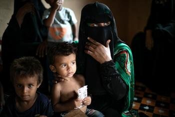 يتم علاج الأطفال من سوء التغذية في إحدى العيادات المتنقلة في لحج باليمن.