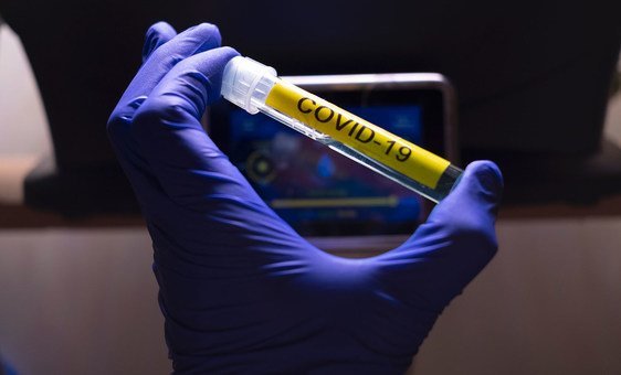 Research is underway to find a vaccine against the coronavirus.