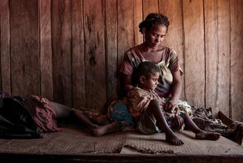 Жители Мадагаскара, пораженного засухой, сталкиваются с острым дефицитом продовольствия. Мадагаскар - одна из 15 стран, где растет число истощенных от голода детей. 