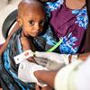 طفل يبلغ من العمر عامًا واحدًا يعاني من سوء التغذية الحاد يتم قياس محيط ذراعه في مستشفى في دولو ، إثيوبيا.