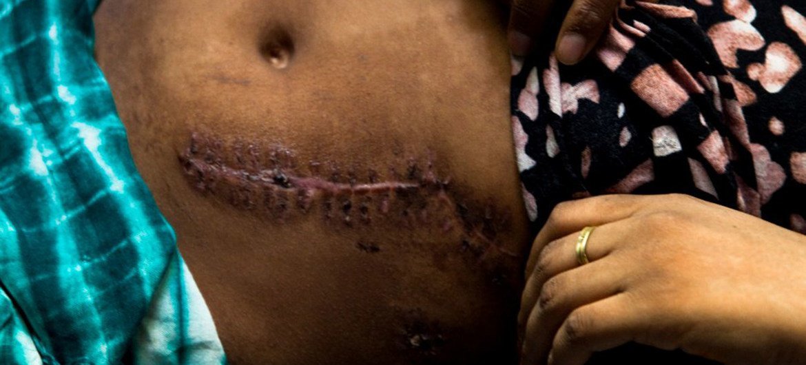 Après un court mariage informel, une Ethiopienne de passage âgée de 15 ans a été gravement poignardée par l'homme qui l'avait abandonnée après lui avoir promis de l'accompagner au Yémen , lors d’une crise de jalousie.