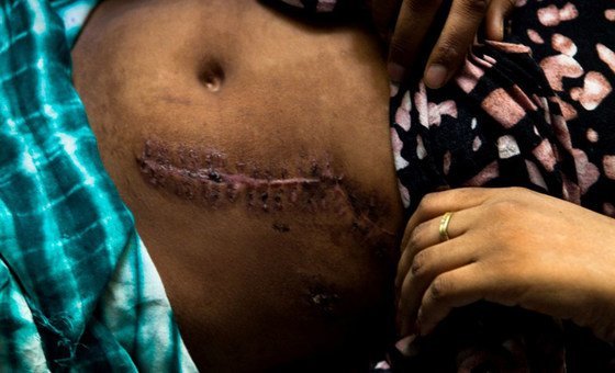 After a short, informal marriage, a transient 15-year-old Ethiopian girl was severely stabbed when the man  who had deserted her after promising to see her to Yemen, flew into a jealous rage.
