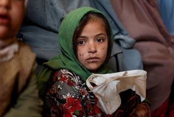 阿富汗坎大哈，一名年轻女孩在联合国儿童基金会资助的一家医疗诊所候诊。