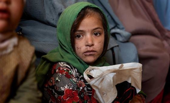 یک دختر جوان در اتاق انتظار یک کلینیک پزشکی تحت حمایت یونیسف در قندهار، افغانستان.
