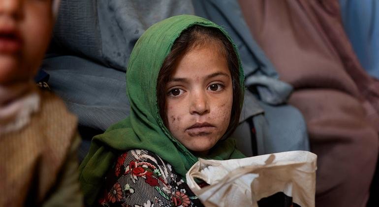 阿富汗坎大哈，一名年轻女孩在联合国儿童基金会资助的一家医疗诊所候诊。