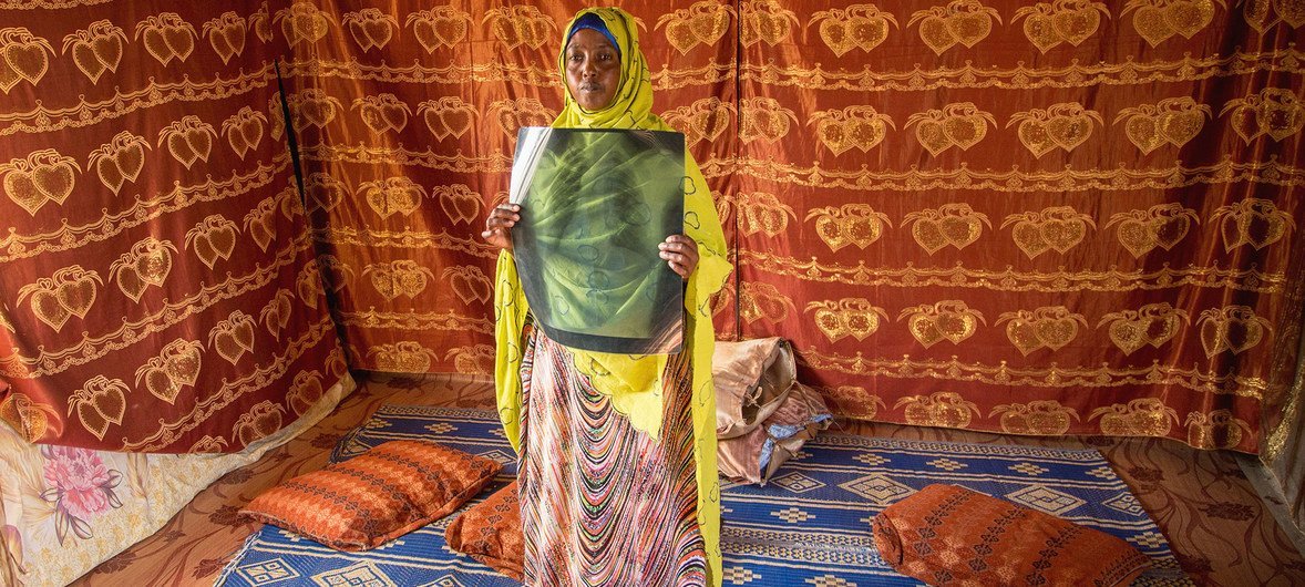 في معسكر للاجئين في جيبوتي، لاجئة صومالية مصابة مصابة بمرض السل منذ 2017، تحمل صورة أشعة لصدرها 