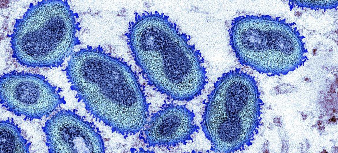 Imagen de microscopio del virus de la viruela del mono