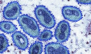 La variole du singe se répand en Europe et en Amérique du Nord.