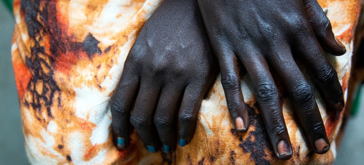 一名被丈夫殴打的南苏丹妇女在她哥哥的房子里寻求庇护。