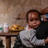 الطفل لايتون (سنة) يتلقى ادواء للعلاج من نقص المناعة كل يوم وفي نفس الساعة في بيته الواقع بمبارارا في أوغندة
