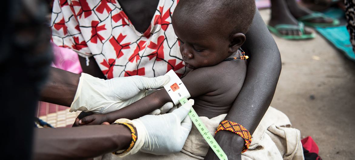 Un enfant fait l'objet d'un dépistage dans une clinique du Soudan du Sud.