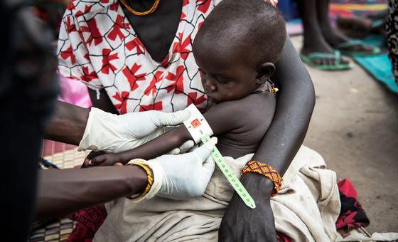 A child being screened at a clinic in South Sudan