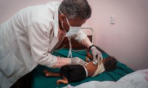 طبيب يستمع إلى دقات قلب طفل يعاني من سوء التغذية في اليمن.