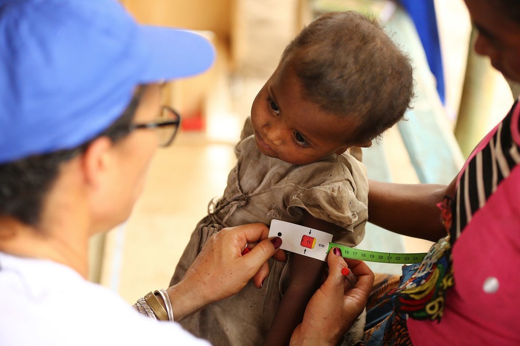 Un enfant subit un test de malnutrition à Madagascar.
