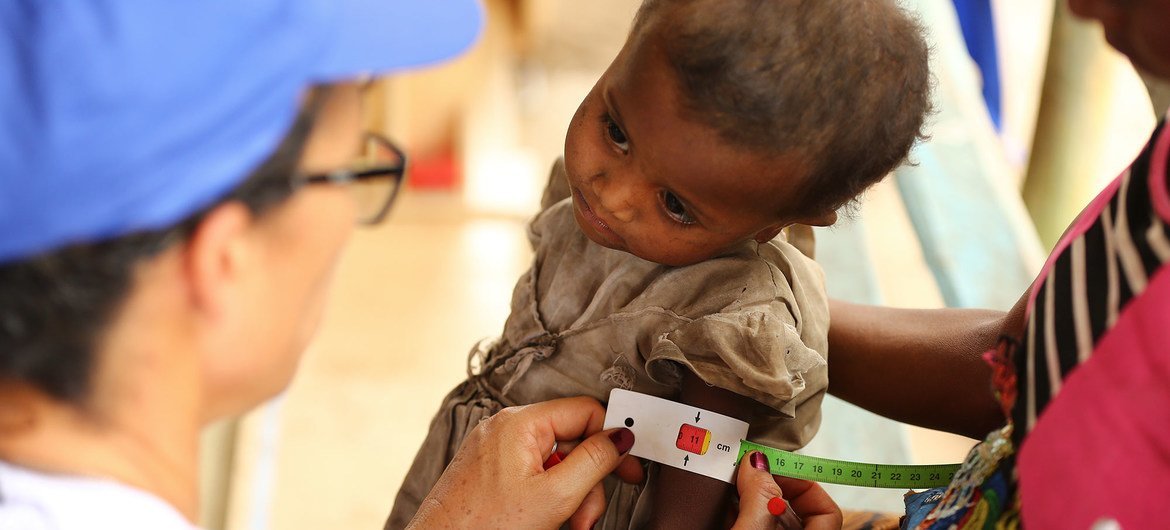 A child undergoes a malnutrition test in Madagascar.