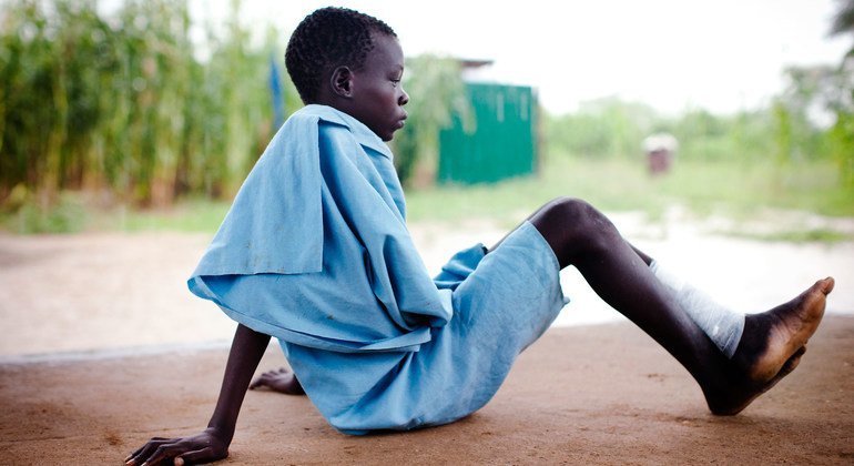 Menino no Sudão do Sul acaba de receber tratamento para dracunliasis