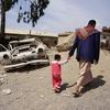 رجل يسير مع ابنته البالغة من العمر ثلاث سنوات في حي حارة المصنع الفقير في صنعاء، اليمن.