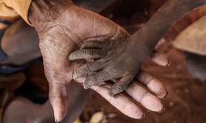 La main d'un enfant souffrant de malnutrition est posée sur les mains de sa grand-mère. L'enfant vit à Kobamirafo, à 50 minutes de marche du Centre de santé de base d'Ambohimalaza, dans la Région Androy au sud de Madagascar.